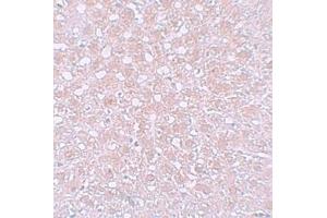 Immunohistochemistry (IHC) image for anti-alpha-Fetoprotein (AFP) (N-Term) antibody (ABIN1031219) (alpha Fetoprotein anticorps  (N-Term))