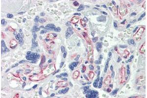 Human Placenta (formalin-fixed, paraffin-embedded) stained with CASP7 antibody ABIN462356 followed by biotinylated anti-mouse IgG secondary antibody ABIN481714, alkaline phosphatase-streptavidin and chromogen.