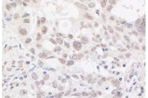 Immunohistochemistry (IHC) image for anti-AT Rich Interactive Domain 2 (ARID, RFX-Like) (ARID2) (AA 1785-1835) antibody (ABIN7453593)