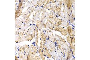 Immunohistochemistry of paraffin-embedded rat heart using MBNL1 antibody at dilution of 1:100 (x40 lens). (MBNL1 anticorps)