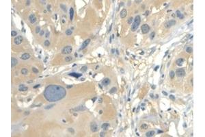 Detection of CALML3 in Human Esophagus Tissue using Polyclonal Antibody to Calmodulin Like Protein 3 (CALML3) (CALML3 anticorps  (AA 1-149))