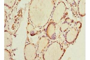 Immunohistochemistry of paraffin-embedded human thyroid tissue using ABIN7172156 at dilution of 1:100 (THRSP anticorps  (AA 1-146))