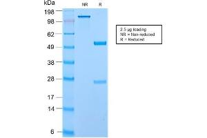 SDS-PAGE Analysis of Purified Secretory Component Rabbit Recombinant Monoclonal (ECM1/2889R).