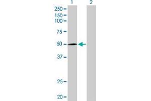 Western Blot analysis of CYP2R1 expression in transfected 293T cell line by CYP2R1 MaxPab polyclonal antibody.