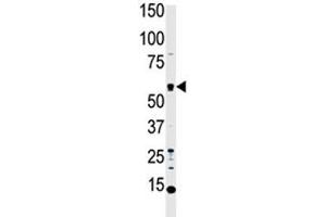 Western blot analysis of MST1 antibody and HL-60 cell lysate.