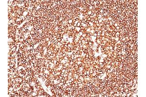 Formalin-fixed, paraffin-embedded human Tonsil stained with CD45 Mouse Monoclonal Antibody (2B11+PD7/26). (CD45 anticorps  (FITC))