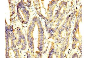 anti-Pyruvate Kinase M1/2 (PKM) (AA 185-461) antibody