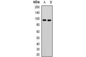 Western blot analysis of KANSL3 expression in Jurkat (A), U251 (B) whole cell lysates.