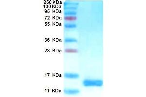 SDS-PAGE with Coomassie Blue staining