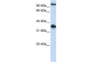 C9ORF4 antibody used at 1 ug/ml to detect target protein. (Ferric-Chelate Reductase 1 Like (FRRS1L) (N-Term) anticorps)
