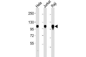 All lanes : Anti-ITGA7 Antibody (C-term) at 1:2000 dilution Lane 1: Hela whole cell lysates Lane 2: Jurkat whole cell lysates Lane 3: Raji whole cell lysates Lysates/proteins at 20 μg per lane. (ITGA7 anticorps  (C-Term))