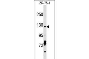 CCD Antibody (C-term) (ABIN1537645 and ABIN2849114) western blot analysis in ZR-75-1 cell line lysates (35 μg/lane). (Syndetin/VPS50 anticorps  (C-Term))