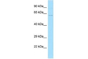 WB Suggested Anti-ZC3H12D Antibody Titration: 1. (ZC3H12D anticorps  (C-Term))