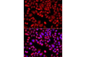 Immunofluorescence analysis of  cells using  antibody (ABIN6129197, ABIN6137129, ABIN6137130 and ABIN6223718). (ARPC3 anticorps  (AA 1-178))