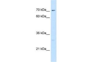 Western Blotting (WB) image for anti-CTP Synthase (CTPS) antibody (ABIN2462930) (CTP Synthase anticorps)