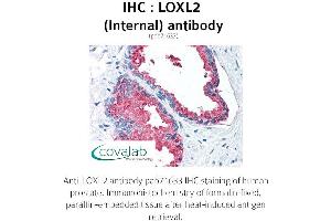 Image no. 2 for anti-Lysyl Oxidase-Like 2 (LOXL2) (Internal Region) antibody (ABIN1736515) (LOXL2 anticorps  (Internal Region))