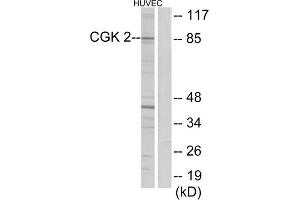 Western blot analysis of extracts from HUVEC cells, using CGK 2 antibody. (PRKG2 anticorps  (Internal Region))