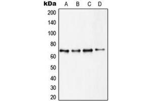Western blot analysis of S6K1 expression in MCF7 (A), HEK293 (B), MDCK (C), mouse brain (D) whole cell lysates. (RPS6KB1 anticorps  (C-Term))