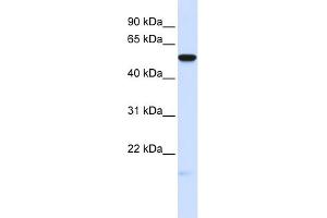 WB Suggested Anti-MFRP Antibody Titration:  0. (MFRP anticorps  (Middle Region))