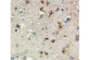 IHC-P analysis of Brain tissue, with DAB staining. (TGFBR3 anticorps  (AA 469-724))