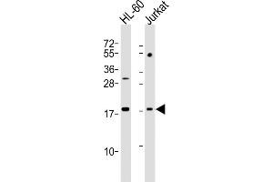 All lanes : Anti-KISS1 Antibody (N-Term) at 1:2000 dilution Lane 1: HL-60 whole cell lysates Lane 2: Jurkat whole cell lysates Lysates/proteins at 20 μg per lane.