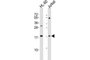 All lanes : Anti-KISS1 Antibody (N-Term) at 1:2000 dilution Lane 1: HL-60 whole cell lysates Lane 2: Jurkat whole cell lysates Lysates/proteins at 20 μg per lane. (KISS1 anticorps  (AA 20-52))