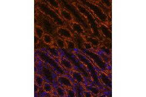 Immunofluorescence analysis of rat kidney using L Polyclonal Antibody (ABIN6128174, ABIN6143076, ABIN6143077 and ABIN6219002) at dilution of 1:100 (40x lens).