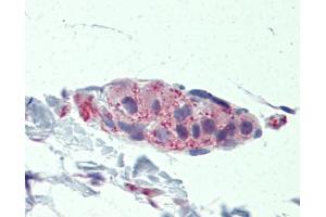Immunohistochemistry (IHC) image for anti-Tankyrase, TRF1-Interacting Ankyrin-Related ADP-Ribose Polymerase (TNKS) (Middle Region) antibody (ABIN404896) (TNKS anticorps  (Middle Region))