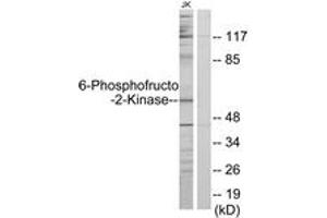 Western blot analysis of extracts from Jurkat cells, using PFKFB2 Antibody. (PFKFB2 anticorps  (AA 1-50))