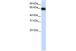 WB Suggested Anti-ADAM12 Antibody Titration:  0. (ADAM12 anticorps  (N-Term))