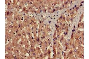 Immunohistochemistry of paraffin-embedded human liver tissue using ABIN7175541 at dilution of 1:100 (PROC anticorps  (AA 288-409))