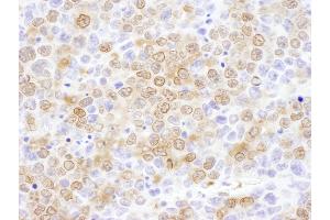 Immunohistochemistry (IHC) image for anti-NUDC (AA 281-331) antibody (ABIN7455044) (NUDC anticorps  (AA 281-331))