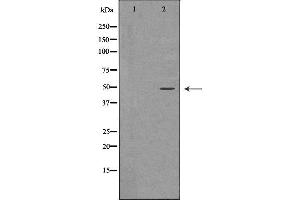 Western blot analysis of Hela whole cell lysates, using PSMC4 Antibody.