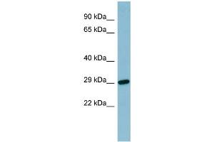 WB Suggested Anti-RBP4 Antibody Titration:  0.