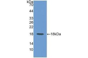 Detection of Recombinant CD99, Rat using Polyclonal Antibody to Cluster Of Differentiation 99 (CD99) (CD99 anticorps  (AA 26-160))