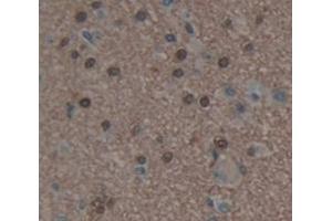IHC-P analysis of Human Tissue, with DAB staining. (HDAC9 anticorps  (AA 23-343))