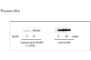 Image no. 3 for Epidermal Growth Factor Receptor (EGFR) ELISA Kit (ABIN625238) (EGFR Kit ELISA)