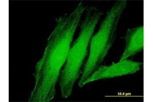 Immunofluorescence of purified MaxPab antibody to EXOSC1 on HeLa cell.