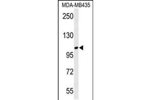 Western blot analysis of LUZP1 Antibody in MDA-MB435 cell line lysates (35ug/lane)