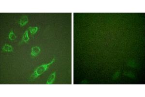 PMA + -Immunofluorescence analysis of HeLa cells, treated with PMA (125ng/ml, 30mins), using 14-3-3 ζ (phospho-Ser58) antibody. (14-3-3 zeta anticorps  (pSer58))