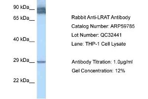 Western Blotting (WB) image for anti-Lecithin Retinol Acyltransferase (Phosphatidylcholine--Retinol O-Acyltransferase) (LRAT) (N-Term) antibody (ABIN2788210) (LRAT anticorps  (N-Term))