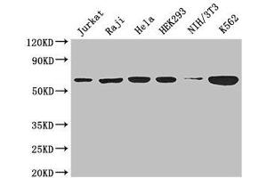 Western Blot Positive WB detected in: Jurkat whole cell lysate, Raji whole cell lysate, Hela whole cell lysate, HEK293 whole cell lysate, NIH/3T3 whole cell lysate, K562 whole cell lysate All lanes: CCT8 antibody at 3 μg/mL Secondary Goat polyclonal to rabbit IgG at 1/50000 dilution Predicted band size: 60, 58, 52 kDa Observed band size: 60 kDa (CCT8 anticorps  (AA 224-491))