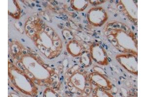 Detection of SCFR in Human Kidney Tissue using Polyclonal Antibody to Stem Cell Factor Receptor (SCFR)
