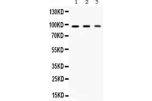 Western blot analysis of Ago2/eIF2C2 expression in rat brain extract ( Lane 1), mouse brain extract ( Lane 2) and HELA whole cell lysates ( Lane 3). (AGO2 anticorps  (N-Term))