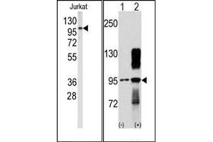 Image no. 1 for anti-Discoidin Domain Receptor tyrosine Kinase 2 (DDR2) antibody (ABIN359957) (DDR2 anticorps)