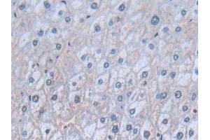 Detection of CD74 in Human Liver Tissue using Polyclonal Antibody to Cluster Of Differentiation 74 (CD74) (CD74 anticorps  (AA 78-222))