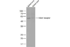 Lane 1: Mouse Spinal cord lysates Lane 2: Rat Spinal cord lysates probed with KiSS1 receptor Polyclonal Antibody, Unconjugated  at 1:2000 dilution and 4˚C overnight incubation. (KISS1R anticorps  (AA 121-200))