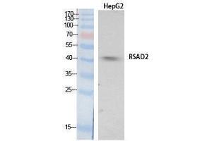 Western Blotting (WB) image for anti-Radical S-Adenosyl Methionine Domain Containing 2 (RSAD2) (Internal Region) antibody (ABIN3181071) (RSAD2 anticorps  (Internal Region))