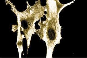 Immunofluorescence staining of human fibroblasts. (Annexin A2 anticorps  (AA 123-328))