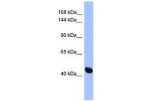 Image no. 1 for anti-Ras Protein-Specific Guanine Nucleotide-Releasing Factor 1 (RASGRF1) (AA 107-156) antibody (ABIN6744091) (RASGRF1 anticorps  (AA 107-156))